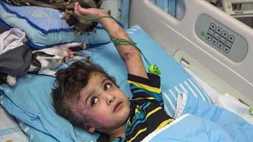 Israël exige que l'Autorité palestinienne règle les frais médicaux des Dawabsheh